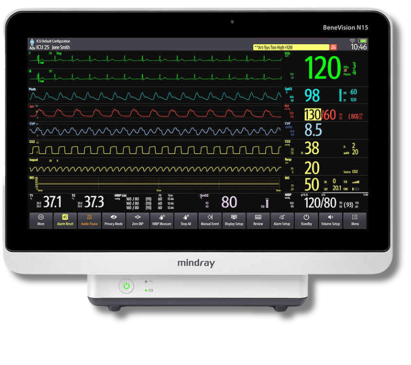 Монитор пациента BeneVision N17/N15/N12, изображение 1